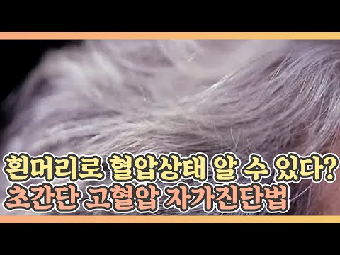 흰머리로 혈압상태를 알 수 있다? 초간단 고혈압 자가진단법 MBN 210326 방송