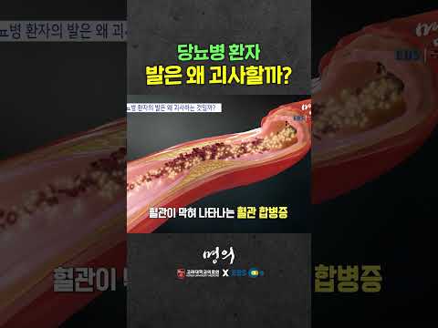 당뇨병 환자 발 괴사하는 이유