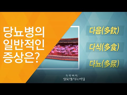 당뇨병의 일반적인 증상은? - (2017.6.21_625회 방송)_당뇨병, 식습관을 고쳐라