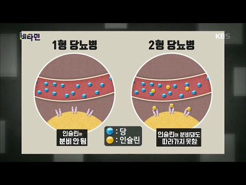 비타민 - 당뇨병, 그 의미와 원인은 무엇인가?.20170216