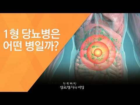 1형 당뇨병은 어떤 병일까? - (2017.3.15_614회 방송)_내몸을지키는방어선,면역력