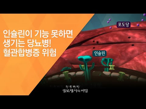 인슐린이 기능 못하면 생기는 당뇨병! 혈관합병증 위험 - (2016.12.14_604회 방송)_암보다 무서운 혈관병 당뇨합병증